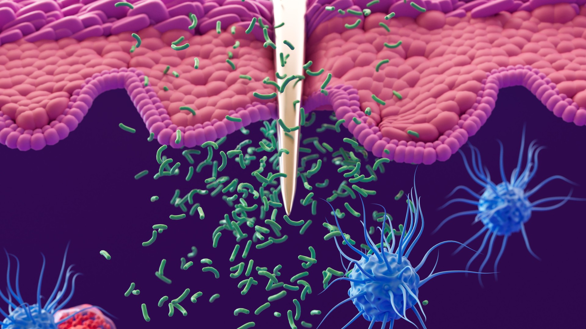 Immune System: Macrophages, Dendritic Cells, and White Blood Cells Defend Against Bacterial Infections and Pathogens